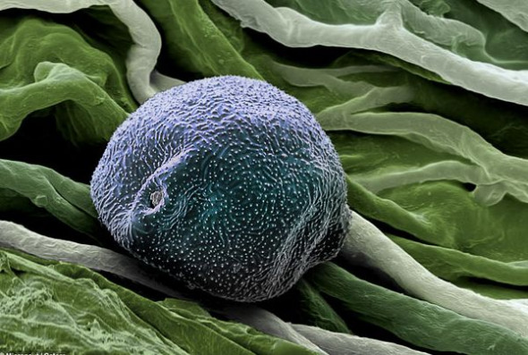 ��Ƭ���������Ļ��ۡ���������������Ӣ�������������ԭ��֮һ������һ����3����5�¼��ͷŻ��ۣ������Ȼ��ߵ�֢״������4����Ϊ���ء�