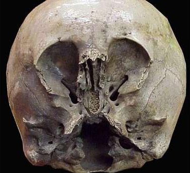 ī�������ͷ�ǣ���Ϊ�����˺͵����˻�Ѫ��