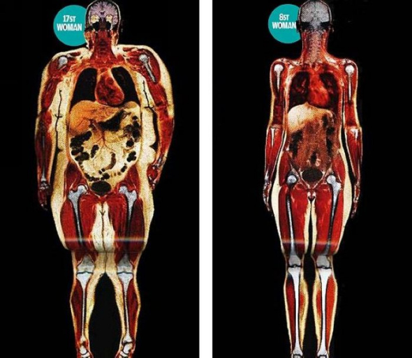 �������ߵĲ��죺��ߵ�<a href=http://www.xinjiewang.com/xingzhishi/11/07/ target=_blank class=infotextkey>����</a><a href=http://www.xinjiewang.com/xingzhishi/6/ target=_blank class=infotextkey><a href=http://www.xinjiewang.com/xingzhishi/6/ target=_blank class=infotextkey>Ů��</a></a>��������Χ�ѻ��˴���֬���������Ѿ������⽫������<a href=http://www.xinjiewang.com target=_blank class=infotextkey><a href=http://www.xinjiewang.com/why/10/ target=_blank class=infotextkey><a href=http://www.xinjiewang.com/shengxiaoxinxi/12/ target=_blank class=infotextkey><a href=http://www.xinjiewang.com/shengxiaoxinxi/13/ target=_blank class=infotextkey><a href=http://www.xinjiewang.com/xingzhishi/ target=_blank class=infotextkey>����</a></a></a></a></a>��������Ӱ�졣